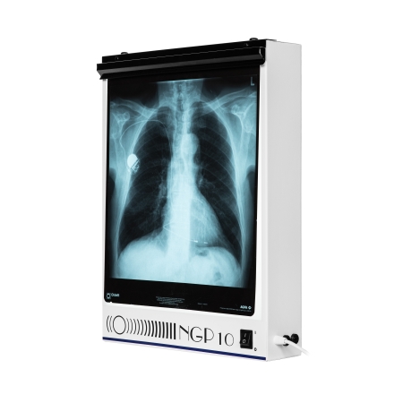 Negatoskop jednoklatkowy NGP 10 hf